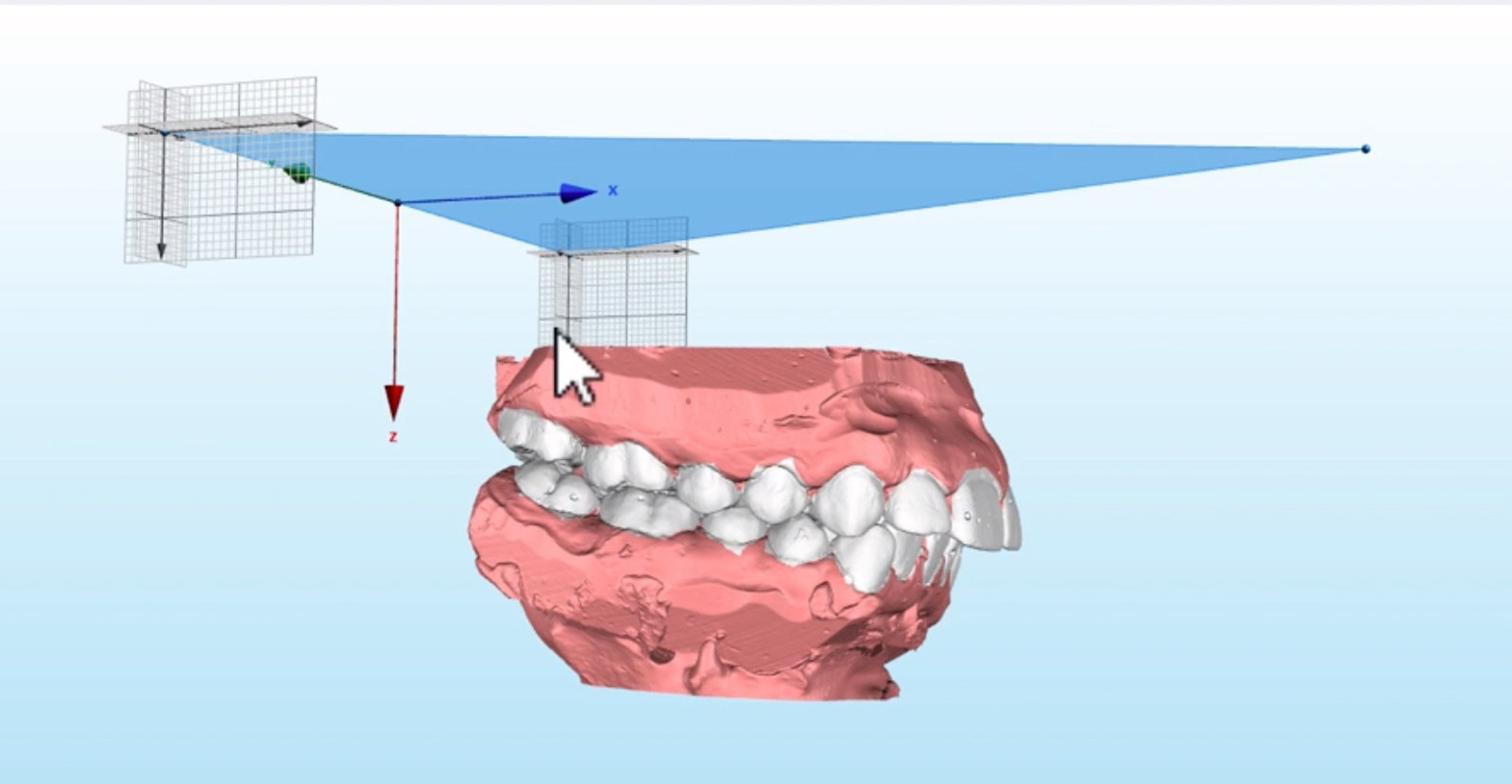 Dental Model Resin (DMR) - Model dentar de culoare bej cu bonturi detașabile și finisaj mat